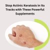Stop Actinic Keratosis in Its Tracks